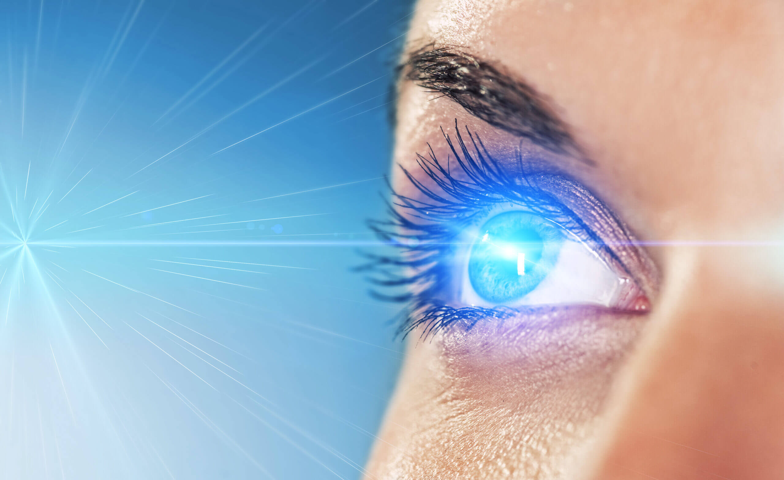 Advancements in LASIK Surgery